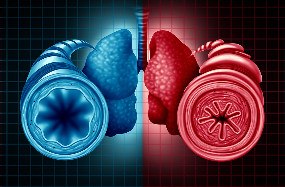 Healthy vs unhealthy bronchial tube